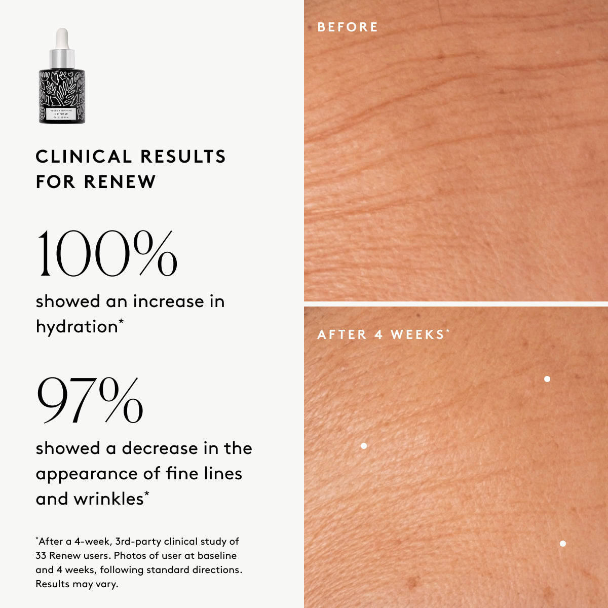 Bestsellers Anti-Aging Duo: Renew, Prevent