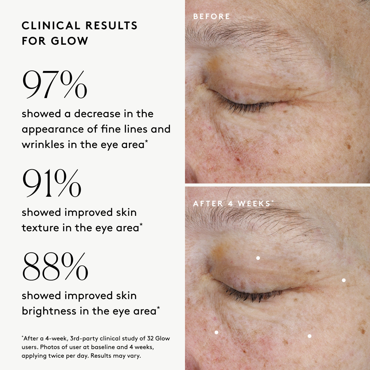 Clinical results chart for Glow Triple Boost Eye Cream showing visible improvements in fine lines, texture, and brightness in the eye area 