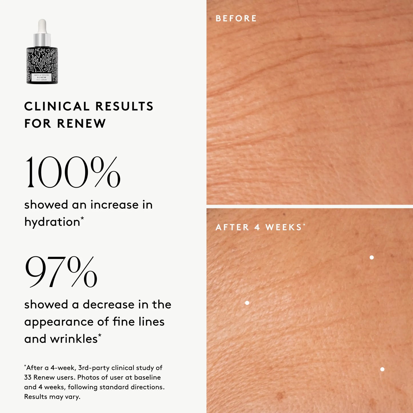 
                
                  Clinical results chart for Illuminate BC+ Brightening Serum: 100% showed increased visible hydration and 94% showed improved visible wrinkles
                
              
