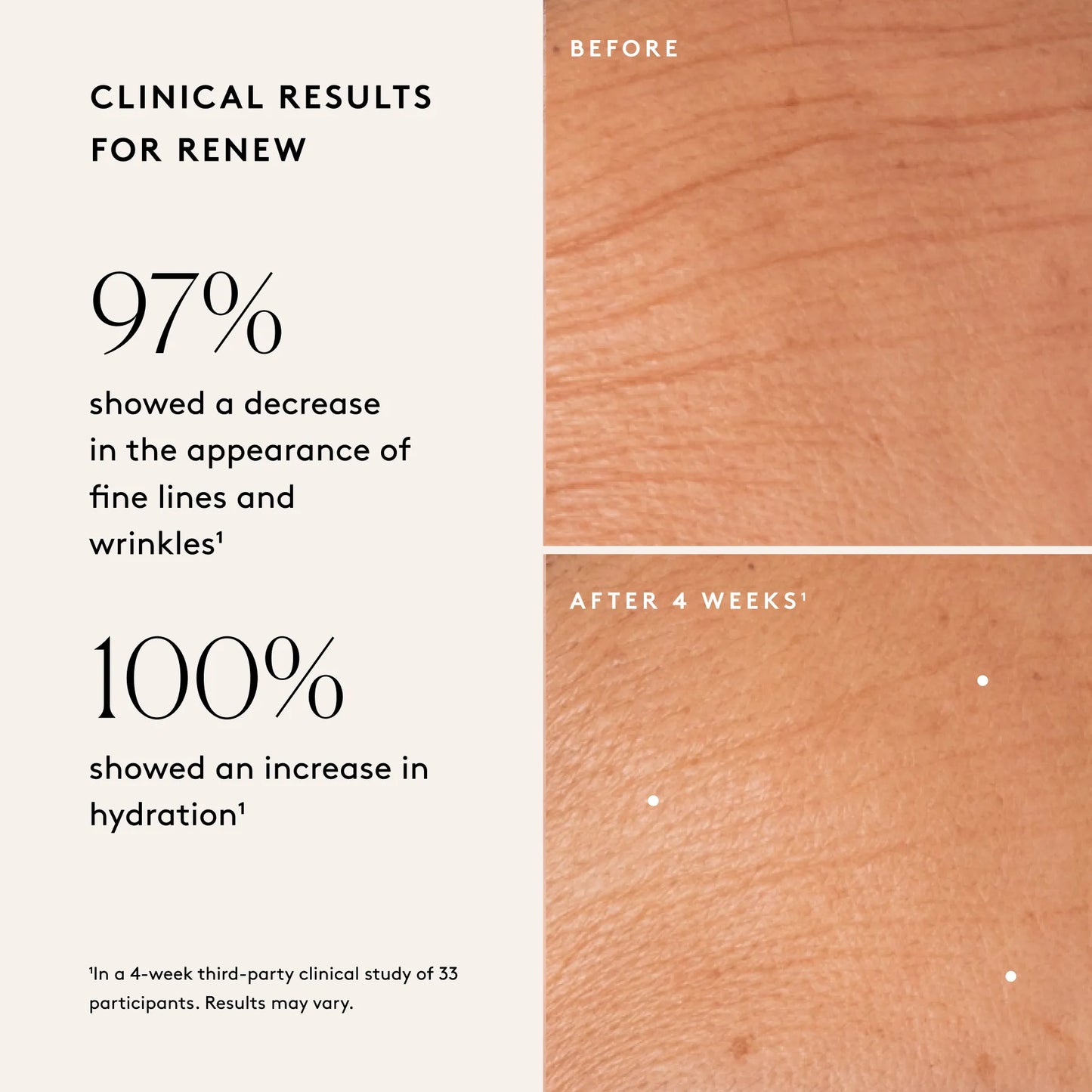 
                
                  Before and after skin images illustrating clinical results after four weeks of use
                
              