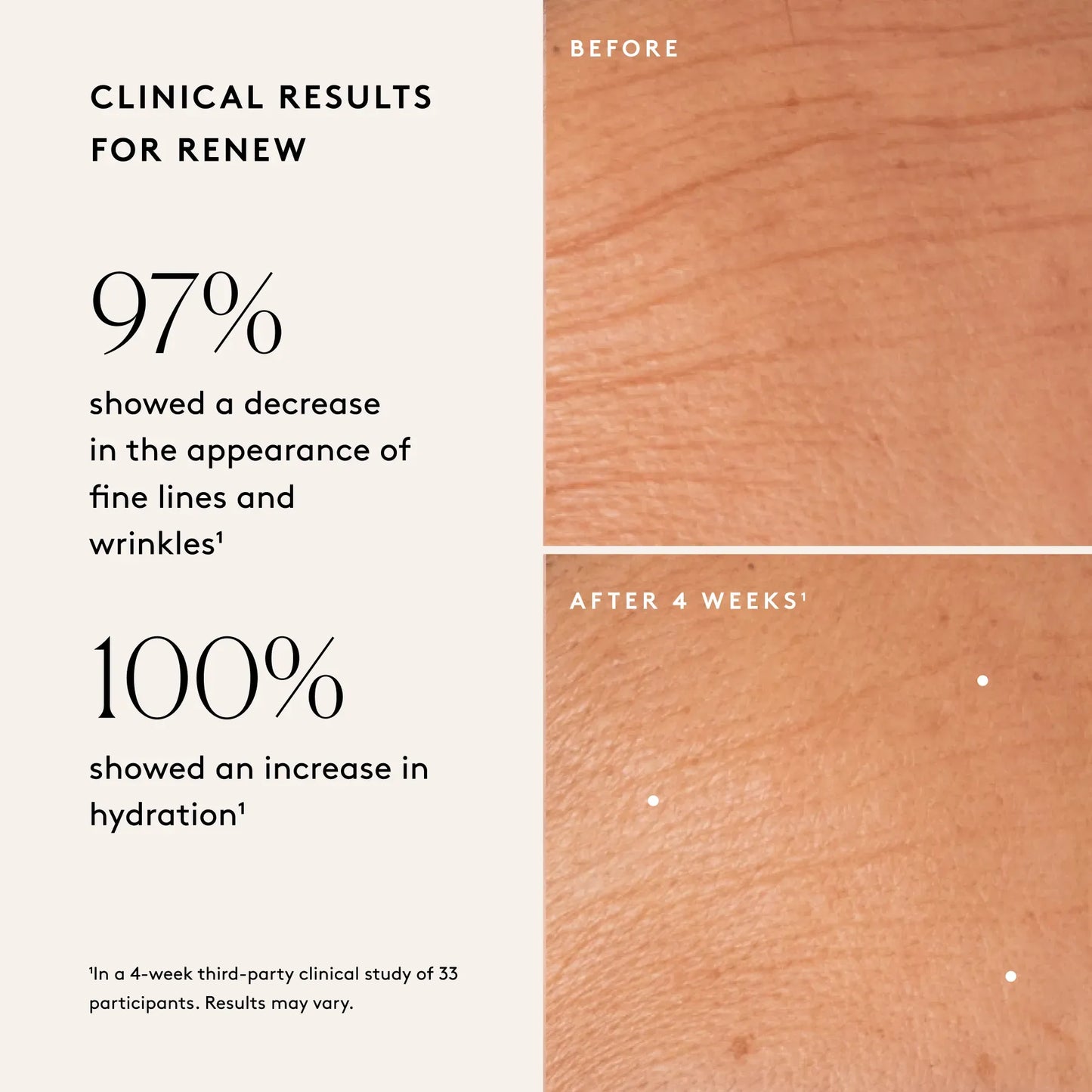 
                
                  Before and after skin images illustrating clinical results after four weeks of use
                
              